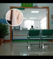 希格玛医用308nm准分子氯化氙光疗仪怎么样