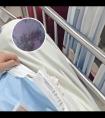308激光治疗副作用大吗